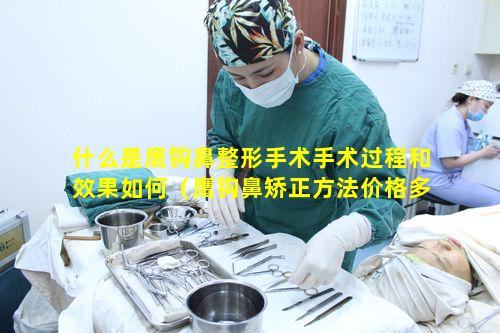 什么是鹰钩鼻整形手术手术过程和效果如何（鹰钩鼻矫正方法价格多少钱）